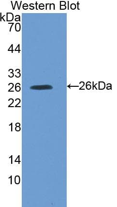 SOCS3 Antibody (aa1-225)