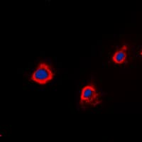 IHC-plus™ PTTG1IP / PBF Antibody (Internal)