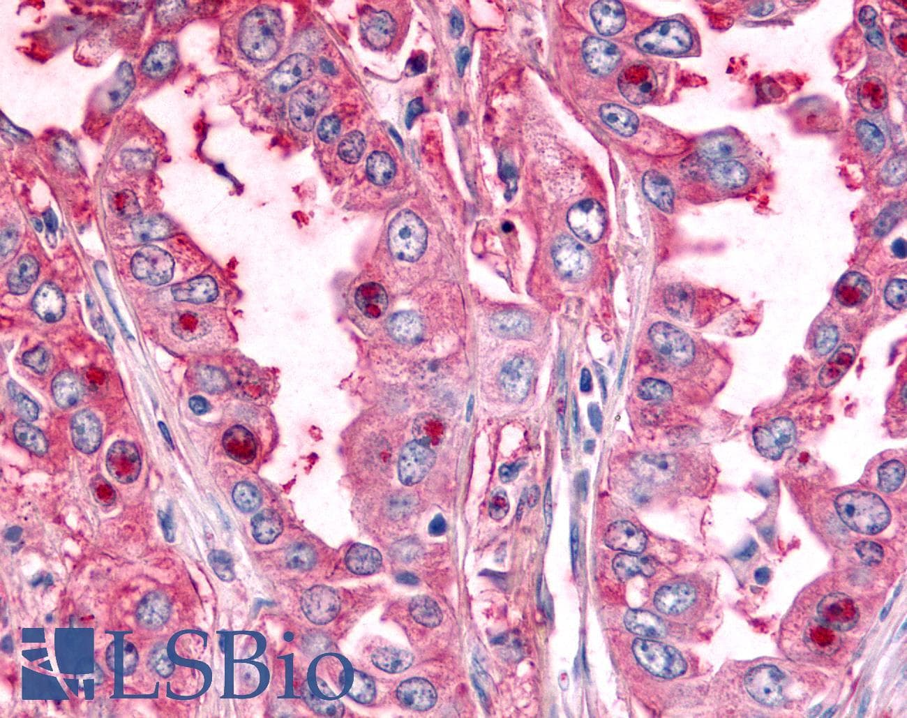 PathPlus™ Polyclonal Rabbit anti-Human PTPRE / PTP Epsilon Antibody (Cytoplasmic Domain, IHC)