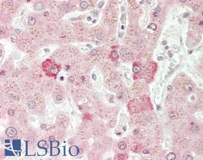 IHC-plus™ ANGPTL3 Antibody (Fibrogen-like domain)