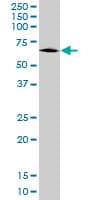ALDH9A1 Antibody (clone 3C6)