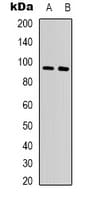 Polyclonal Rabbit anti-Mouse CTNNB1 / Beta Catenin Antibody (IHC, WB)