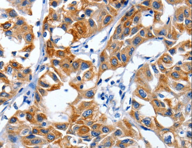 CRD-BP / ZBP1 / IGF2BP1 Antibody