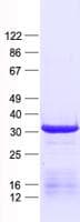 Human UTP11L Protein (Recombinant His, N-Terminal)