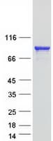 Human KIF3B Protein (Recombinant Myc-DDK (Flag))