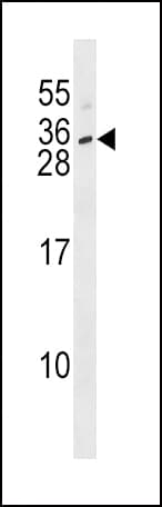 Polyclonal Rabbit anti-Human IL28B Antibody (aa34-63, WB)