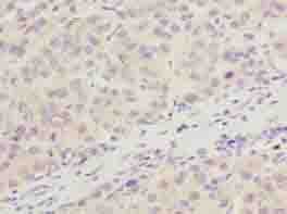 ARMT1 Antibody