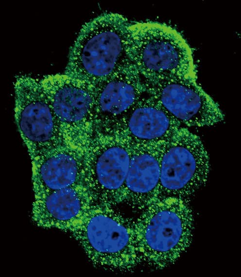 TERT / Telomerase Antibody (phospho-Tyr707)