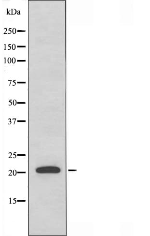 RAB31 Antibody