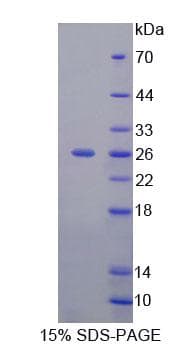 Human FBS1 Protein (Recombinant His-T7, N-terminus)