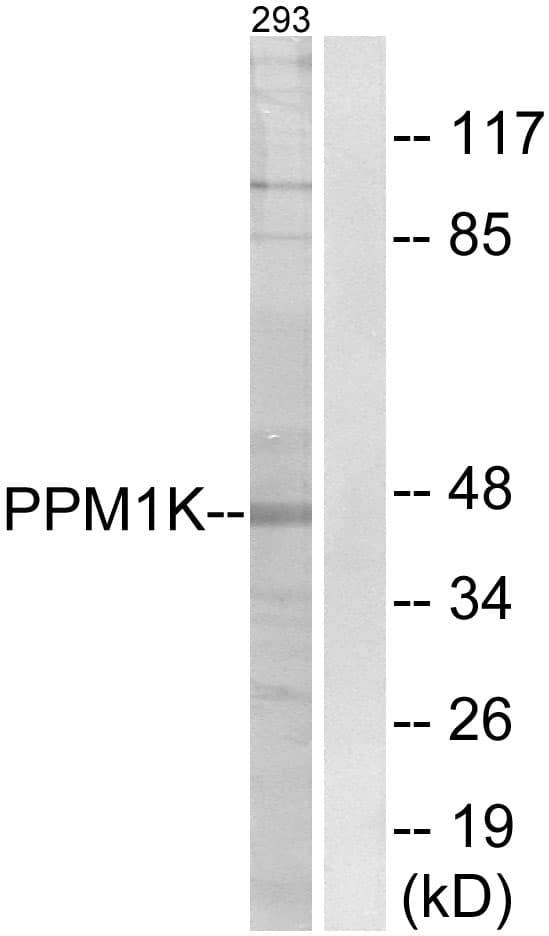 PPM1K Antibody (aa205-254)