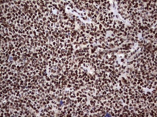 C14orf166 Antibody (clone OTI1B2)