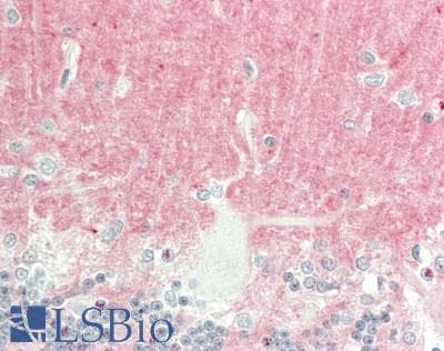 PathPlus™ MCAM / CD146 Antibody (aa84-189, clone 6C3F1)