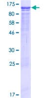 Human C5orf41 Protein (Recombinant GST)
