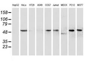 BECN1 / Beclin-1 Antibody (clone OTI3H8)
