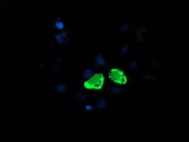 ENPEP / Aminopeptidase A Antibody (clone OTI3E7)