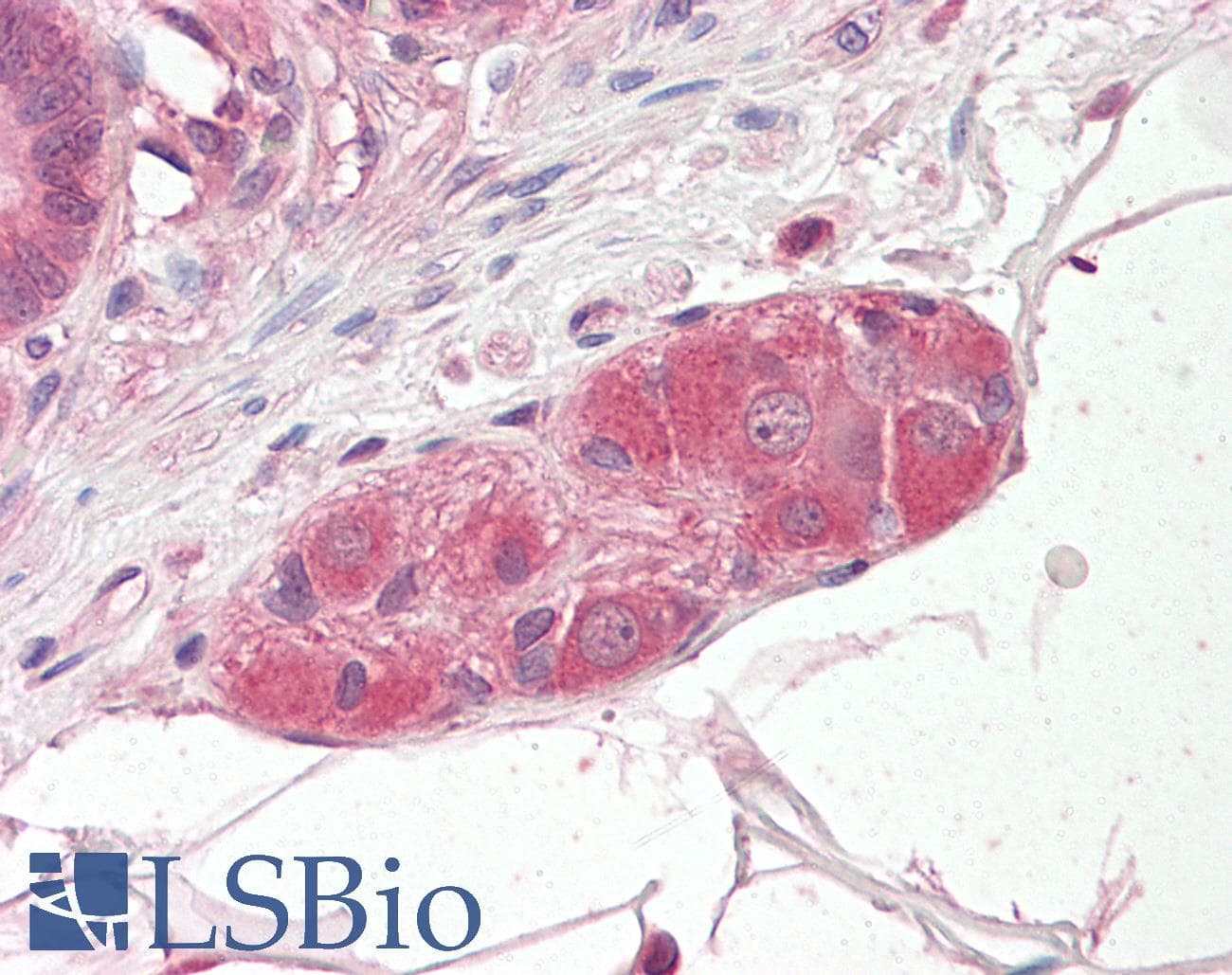 IHC-plus™ KLF8 Antibody (aa2-14)
