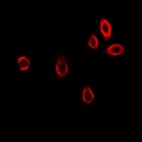 IHC-plus™ GAMT Antibody