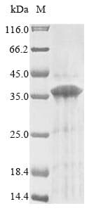 Human GPR157 Protein (Recombinant 10His, N-terminus)