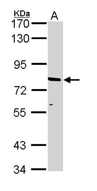 ABCD2 / ALDR Antibody