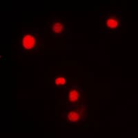 KLF11 Antibody (N-Terminus)