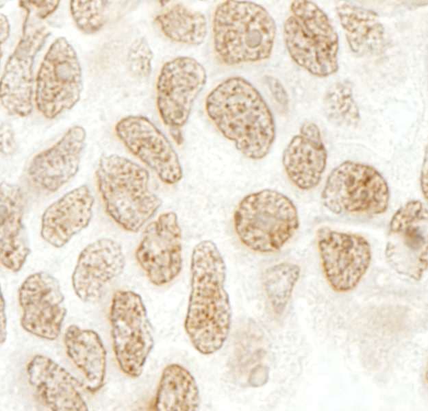 PPIG / Cyclophilin G Antibody (aa450-500)