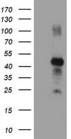 Monoclonal Mouse anti-Human RNF113B Antibody (clone OTI7A1, IHC, IF, WB)