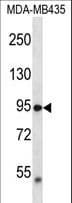 VRL1 / TRPV2 Antibody (aa52-81)
