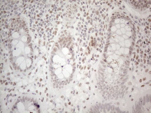 HDAC2 Antibody (aa415-488, clone OTI7E10)