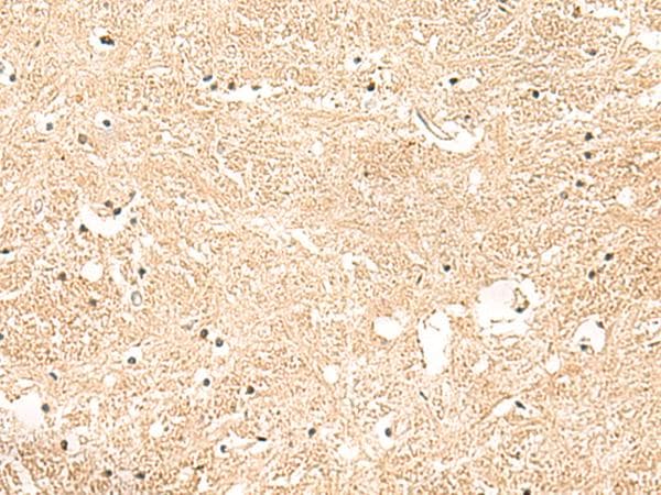 GSTK1 Antibody
