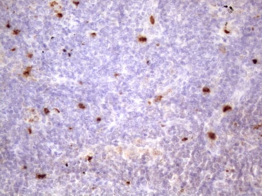 PRTN3 / Myeloblastin Antibody (aa28-248, clone OTI1D10)