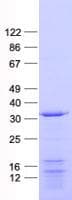 Human CASP2 / Caspase 2 Protein (Recombinant His, N-Terminal)