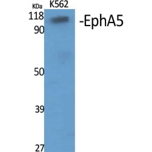 EPHA5 / EPH Receptor A5 Antibody (440-520 aa, Internal)