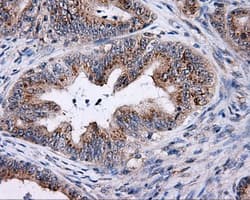 TLDC1 / KIAA1609 Antibody (clone OTI12G10)