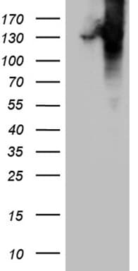 COL6A1 / Collagen VI Alpha 1 Antibody (aa752-835, clone OTI1G8)