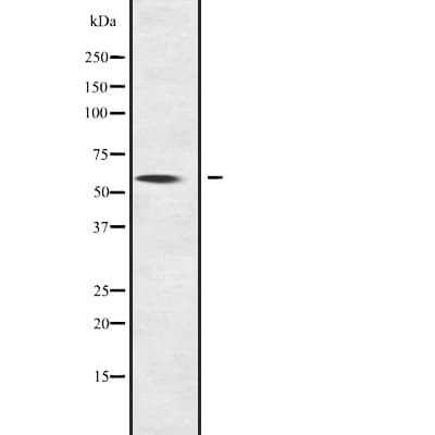 Polyclonal Rabbit anti-Human NOC4L Antibody (IHC, WB)