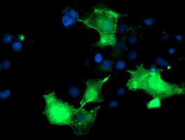PDLIM2 / SLIM Antibody (clone OTI10C4)