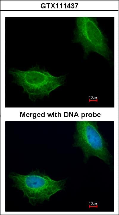 ADCK1 Antibody (aa45-213)