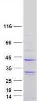 Human CD20 Protein (Recombinant Myc-DDK (Flag))
