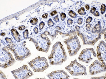 Polyclonal Rabbit anti-Human KRT18 / CK18 / Cytokeratin 18 Antibody (IHC, WB)