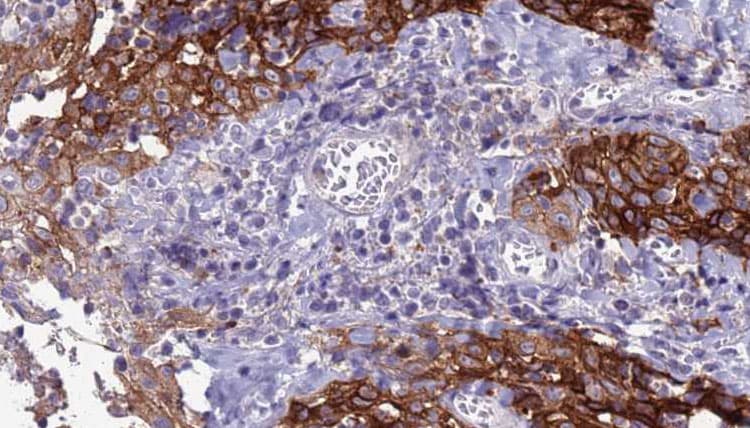 SLC39A8 / ZIP8 Antibody