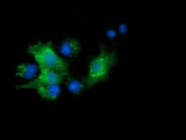 PYCRL Antibody (clone OTI3A8)