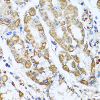 Polyclonal Rabbit anti-Human ANTXR2 / CMG2 Antibody (IHC, WB)