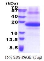 Human SSSCA1 / p27 Protein (Recombinant His)