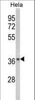 Polyclonal Rabbit anti-Human NFKBIA / IKB Alpha / IKBA Antibody (aa12-41, IHC, IF, WB)