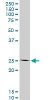 HOXC12 Antibody (clone 1C6)