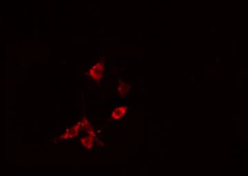 Polyclonal Rabbit anti-Human RHOB Antibody (IHC, IF, WB)