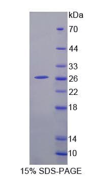 Human ADAMTS9 Protein (Recombinant His-S)