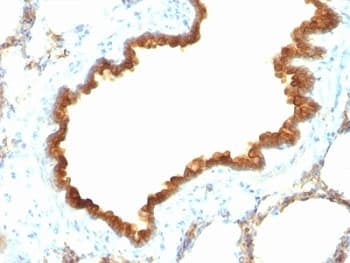 KRT19 / CK19 / Cytokeratin 19 Antibody (clone KRT19/800)