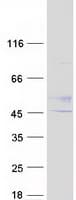 Human B3GNT2 Protein (Recombinant Myc-DDK (Flag))